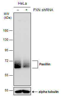 Paxillin Antibody in Western Blot (WB)