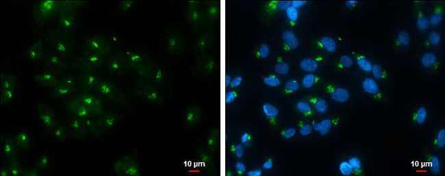 RAP1GAP Antibody in Immunocytochemistry (ICC/IF)