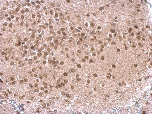 p130 Antibody in Immunohistochemistry (Paraffin) (IHC (P))