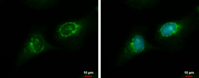 RGS7 Antibody in Immunocytochemistry (ICC/IF)