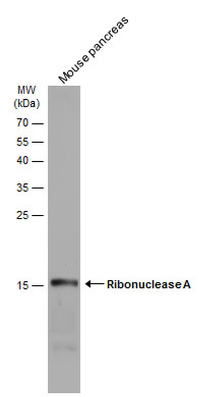 RNase1 Antibody in Western Blot (WB)