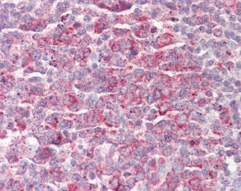MRPL23 Antibody in Immunohistochemistry (Paraffin) (IHC (P))