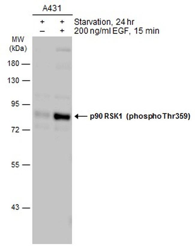 Phospho-RSK1 (Thr359) Antibody in Western Blot (WB)