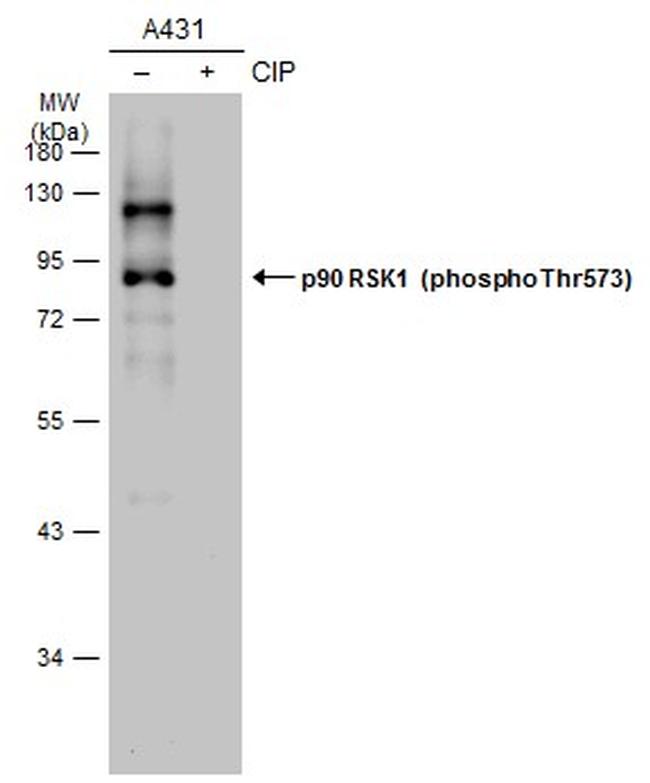 Phospho-RSK1 (Thr573) Antibody in Western Blot (WB)