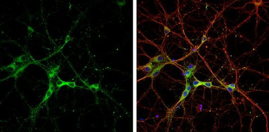 SH3GL1 Antibody in Immunocytochemistry (ICC/IF)