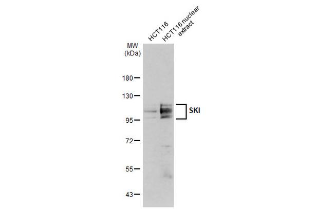 SKI Antibody in Western Blot (WB)