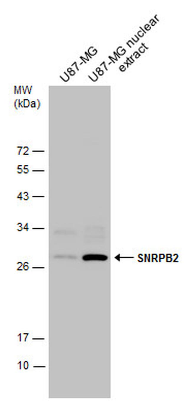 SNRPB2 Antibody in Western Blot (WB)
