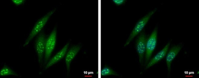 MSP Antibody in Immunocytochemistry (ICC/IF)