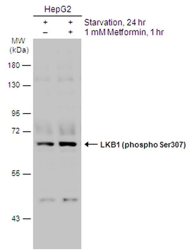 Phospho-LKB1 (Ser307) Antibody in Western Blot (WB)