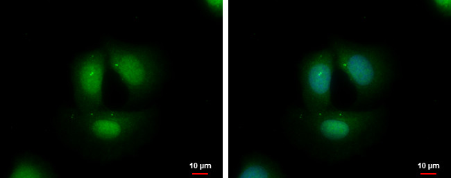 TCF3 Antibody in Immunocytochemistry (ICC/IF)