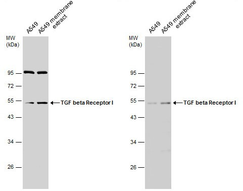 TGFBR1 Antibody in Western Blot (WB)