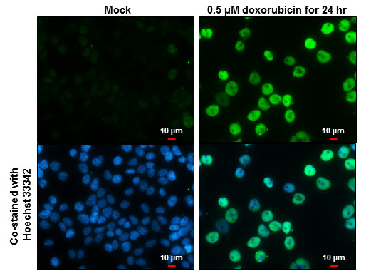 Phospho-p53 (Ser15) Antibody in Immunocytochemistry (ICC/IF)
