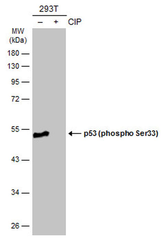 Phospho-p53 (Ser33) Antibody in Western Blot (WB)