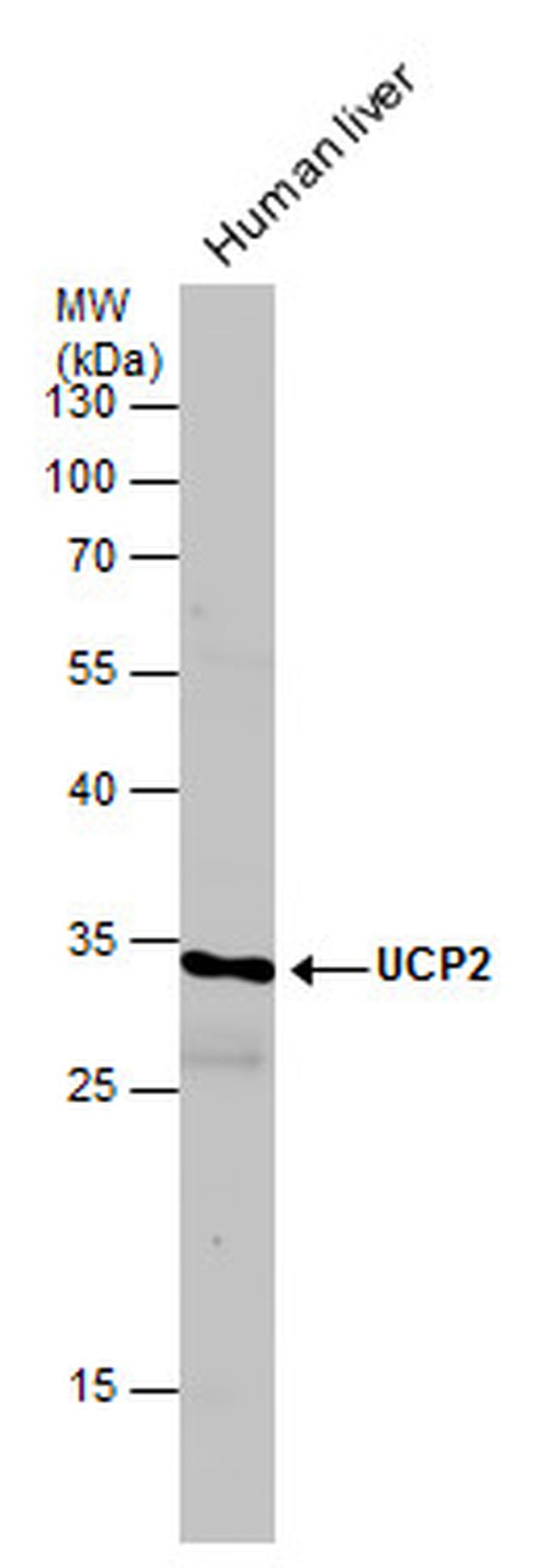 UCP2 Antibody in Western Blot (WB)