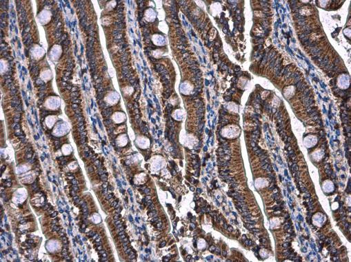 UQCRB Antibody in Immunohistochemistry (Paraffin) (IHC (P))