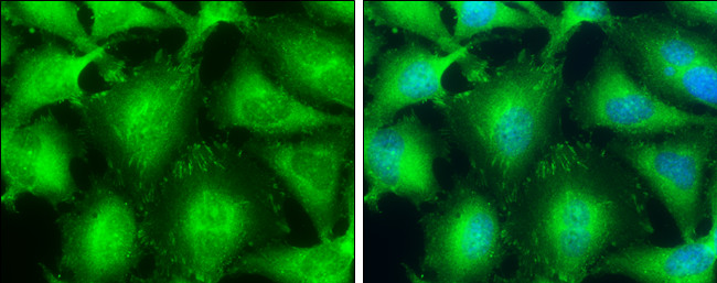VASP Antibody in Immunocytochemistry (ICC/IF)