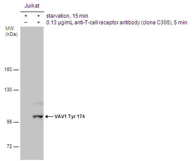 Phospho-VAV1 (Tyr174) Antibody in Western Blot (WB)