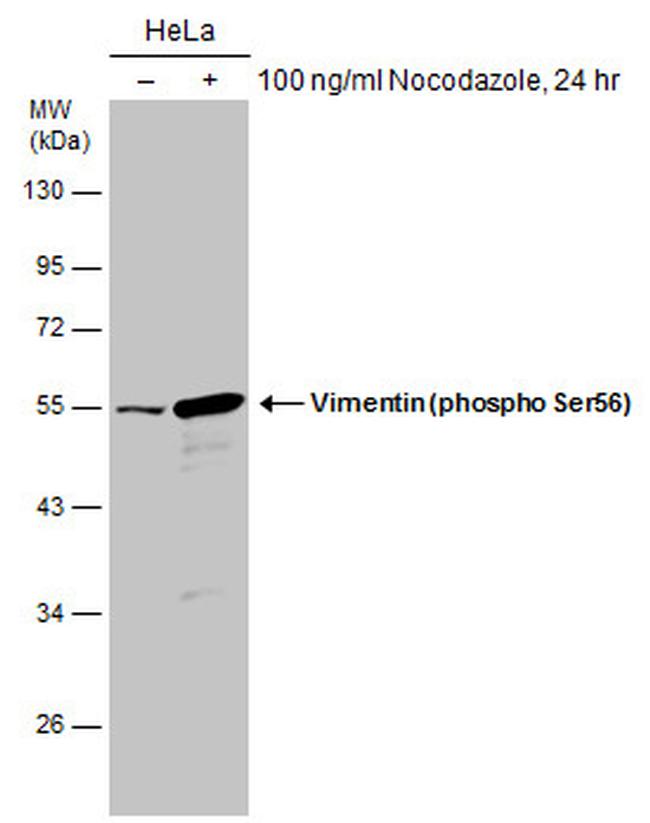 Phospho-Vimentin (Ser56) Antibody in Western Blot (WB)
