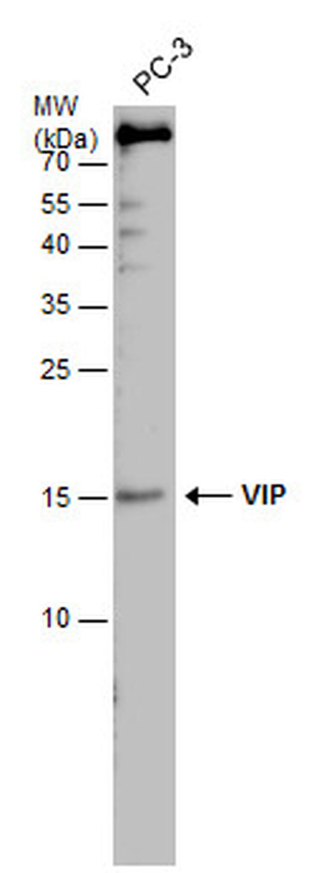 VIP Polyclonal Antibody (PA5-78224)