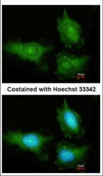 14-3-3 gamma Antibody in Immunocytochemistry (ICC/IF)