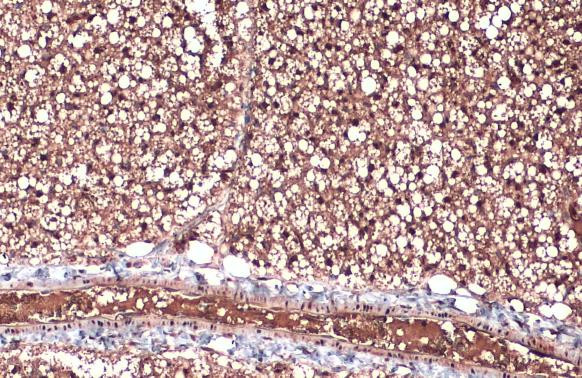 ZIC1 Antibody in Immunohistochemistry (Paraffin) (IHC (P))