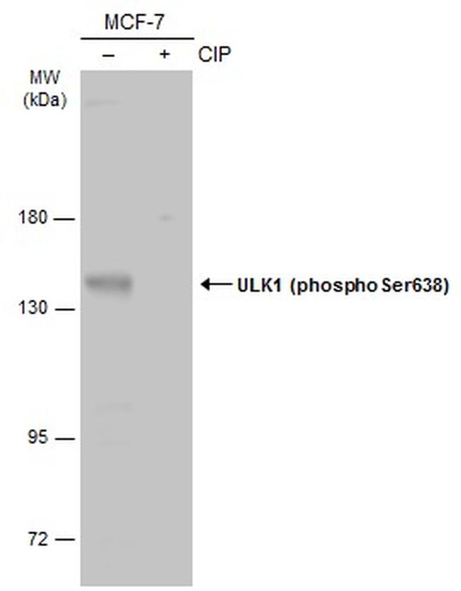 Phospho-ULK1 (Ser638) Antibody in Western Blot (WB)
