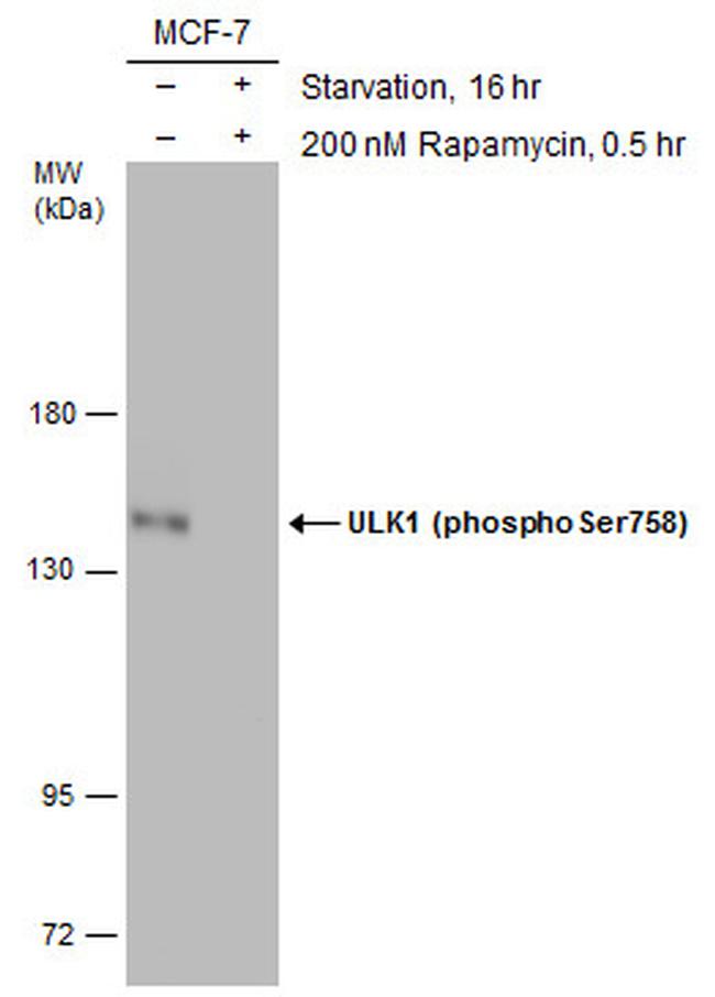 Phospho-ULK1 (Ser758) Antibody in Western Blot (WB)
