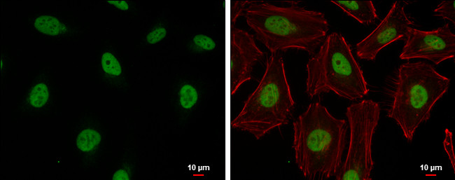 Cullin 4B Antibody in Immunocytochemistry (ICC/IF)