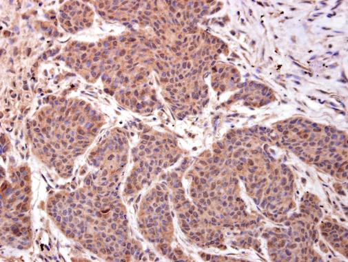 LMO4 Antibody in Immunohistochemistry (Paraffin) (IHC (P))