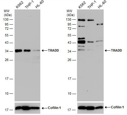 TRADD Antibody in Western Blot (WB)