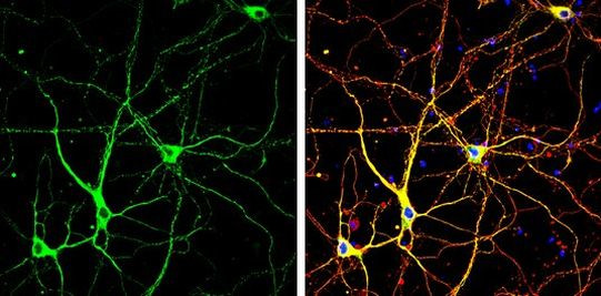 p35 Antibody in Immunocytochemistry (ICC/IF)