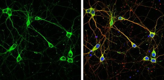 WAVE1 Antibody in Immunocytochemistry (ICC/IF)