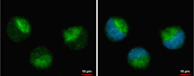 NIK Antibody in Immunocytochemistry (ICC/IF)