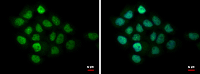 MTA1 Antibody in Immunocytochemistry (ICC/IF)