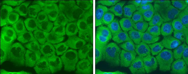 LRRFIP1 Antibody in Immunocytochemistry (ICC/IF)