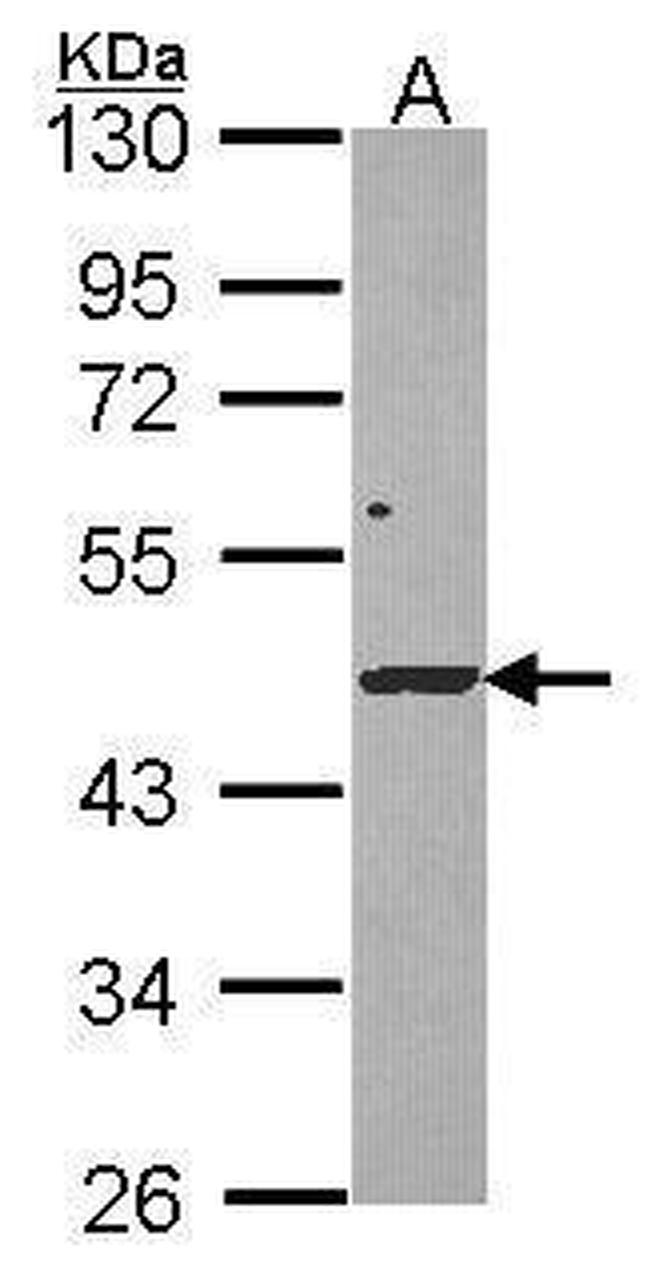 DRAK1 Antibody in Western Blot (WB)