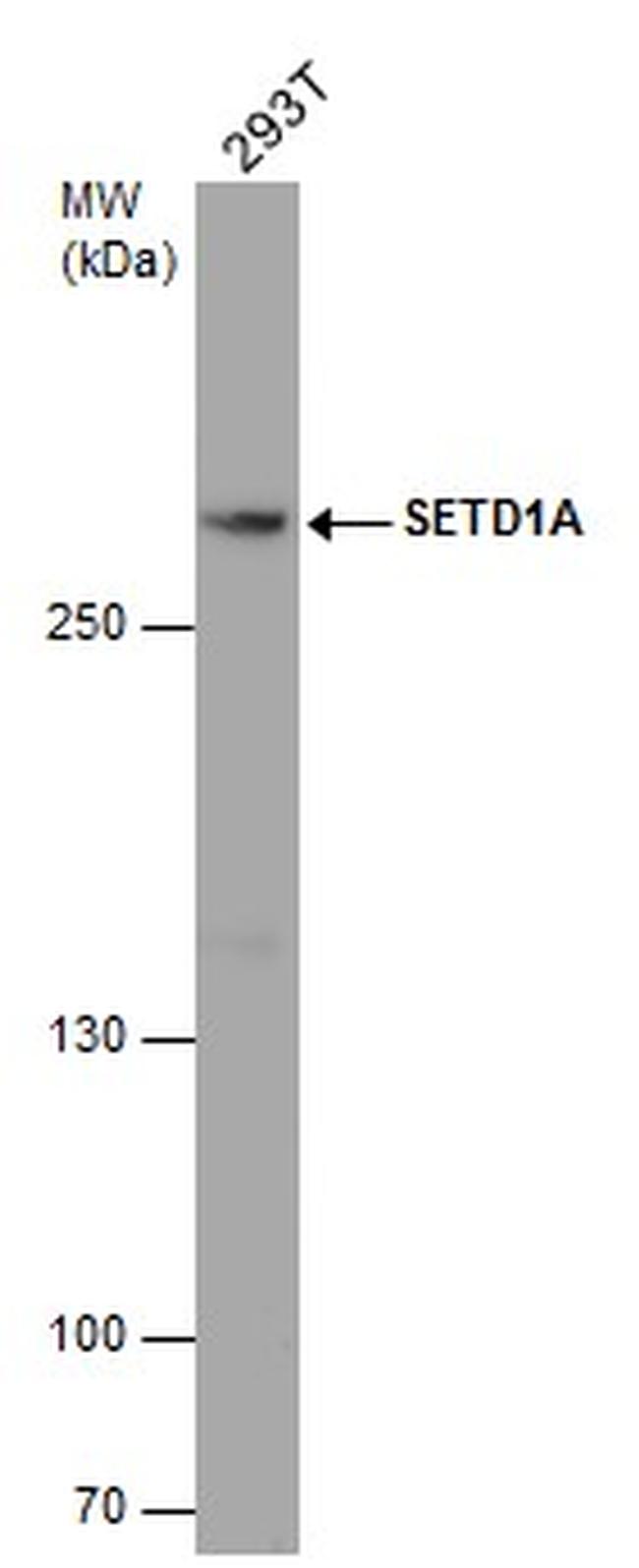 Setd1a Wrad Module SETD1A Polyclonal Antibody | Invitrogen (PA5-78298)