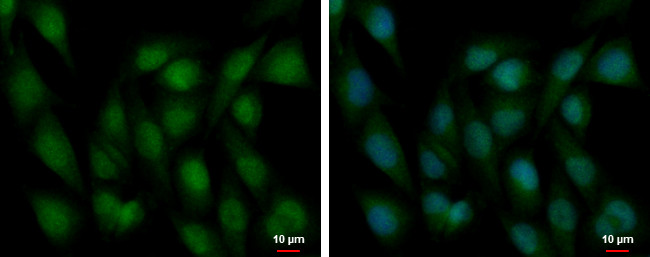 ZEB2 Antibody in Immunocytochemistry (ICC/IF)