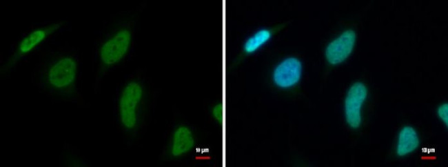 hnRNP DL Antibody in Immunocytochemistry (ICC/IF)