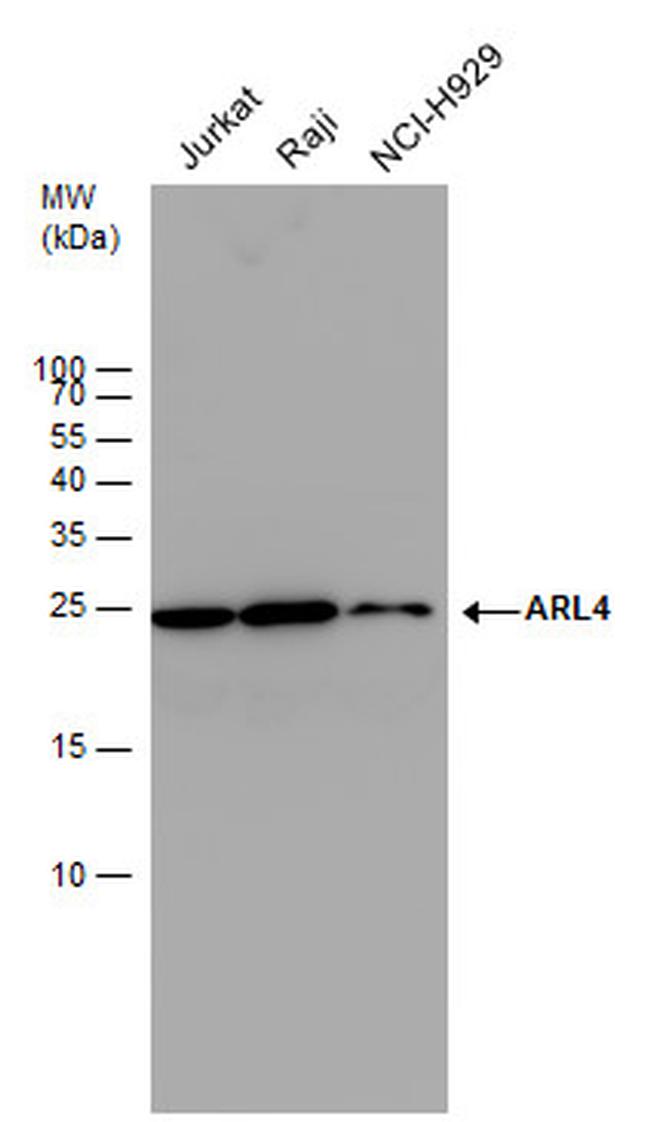 ARL4A Antibody in Western Blot (WB)