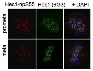 HEC1 Antibody in Immunocytochemistry (ICC/IF)
