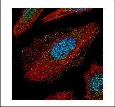 TAB1 Antibody in Immunocytochemistry (ICC/IF)