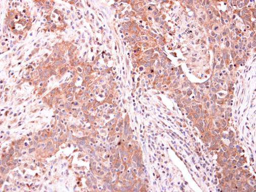 ARPC1A Antibody in Immunohistochemistry (Paraffin) (IHC (P))