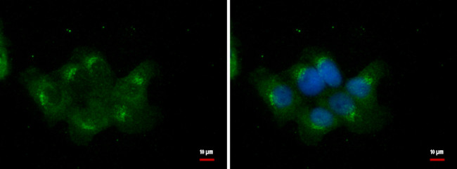 RBCK1 Antibody in Immunocytochemistry (ICC/IF)