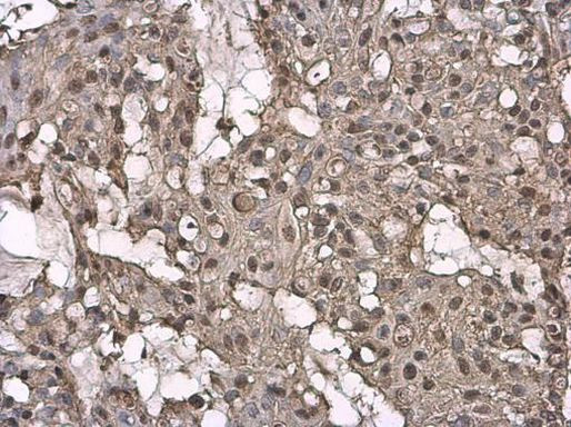 STAG2 Antibody in Immunohistochemistry (Paraffin) (IHC (P))