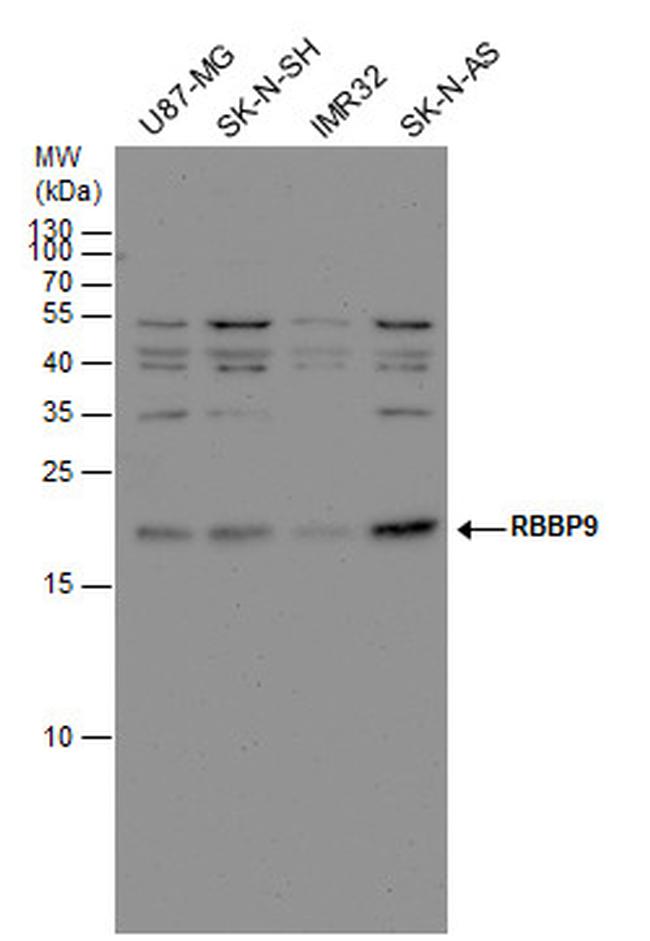 RBBP9 Antibody in Western Blot (WB)