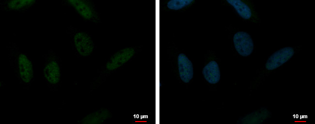 RUVBL2 Antibody in Immunocytochemistry (ICC/IF)
