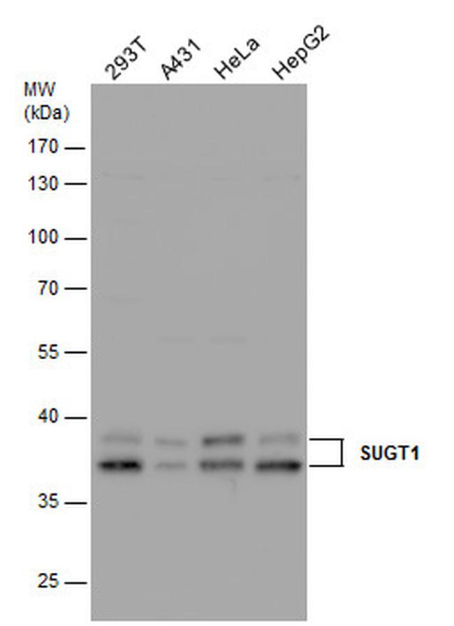 SUGT1 Antibody in Western Blot (WB)