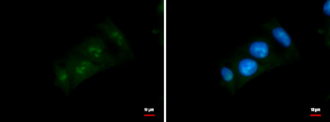 DDX52 Antibody in Immunocytochemistry (ICC/IF)
