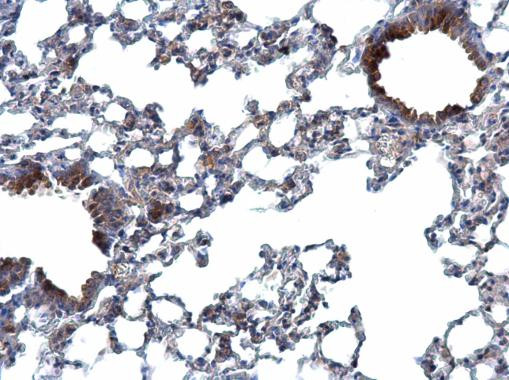 TWF2 Antibody in Immunohistochemistry (Paraffin) (IHC (P))